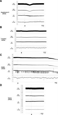 Angiotensinergic and GABAergic transmission in the medial preoptic area: role in urinary bladder and cardiovascular control in female rats